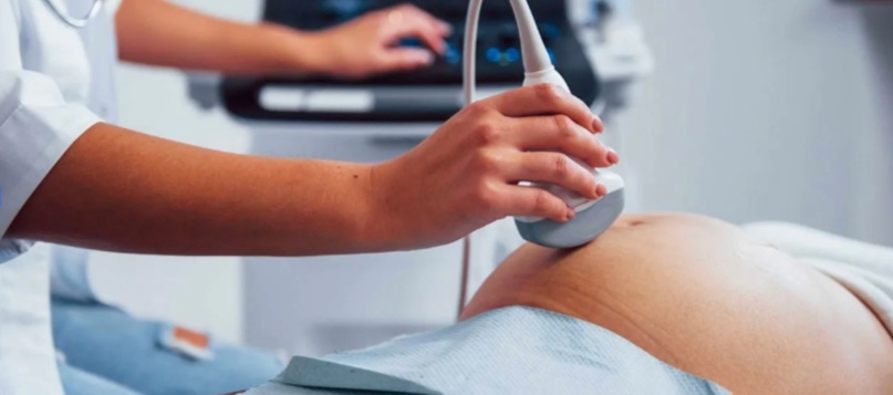 Formation Sage-Femme ASFI